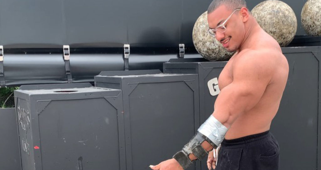Strongman/Powerlifter/Bodybuilder checking his arm after rupturing his proximal head of biceps.