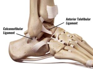 Anterior talofibular ligament 